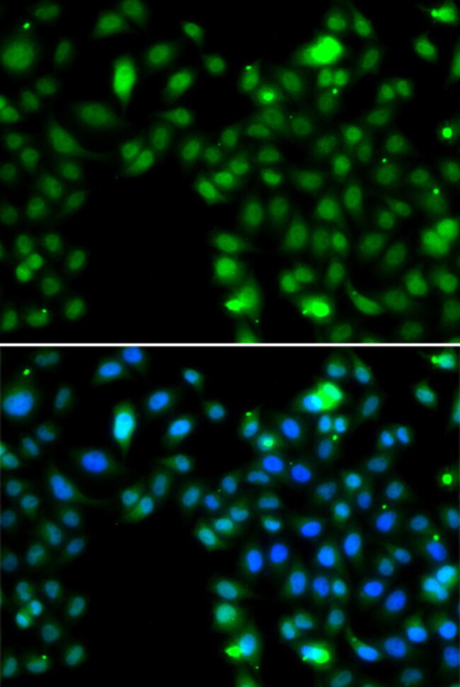 100UL ING5 ANTIBODY 100 ul