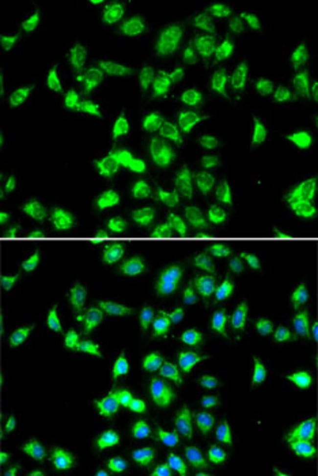 100UL KALLISTATIN ANTIBODY 100 ul