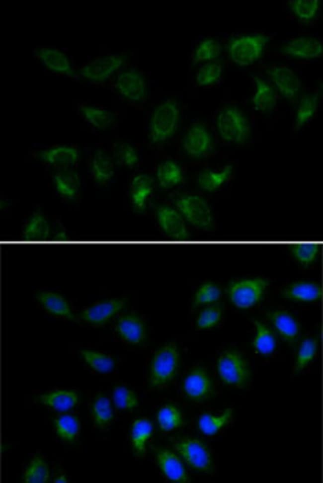 100UL BMP-15 ANTIBODY 100 ul