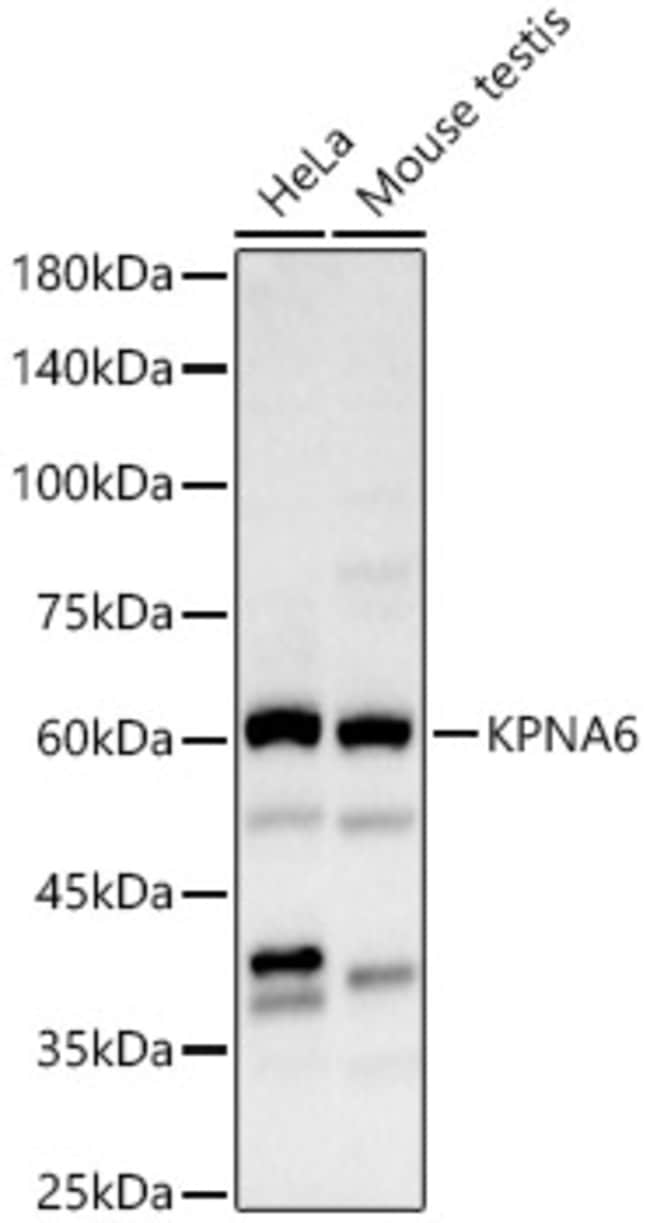 100UL KPNA6 ANTIBODY 100 ul