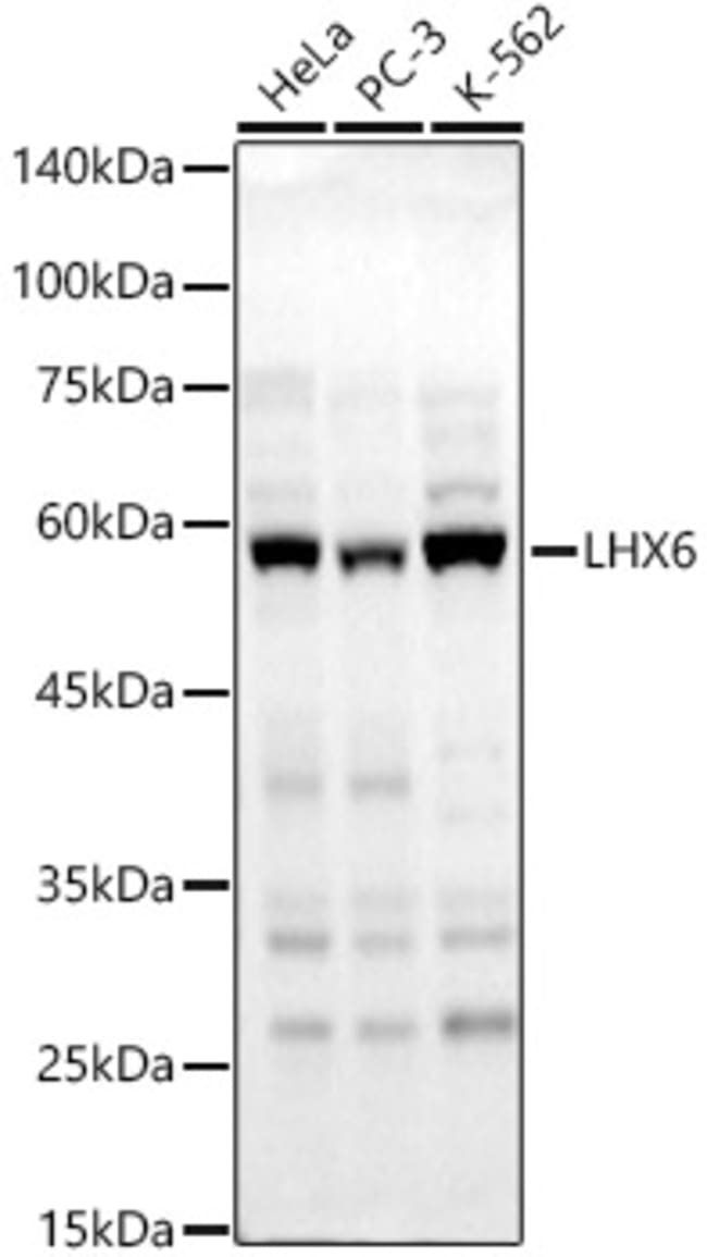 100UL LHX6 ANTIBODY 100 ul