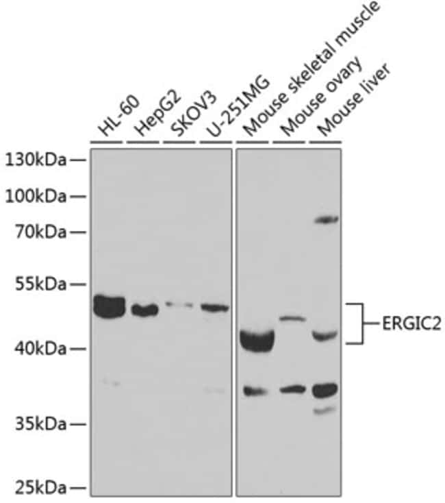 100UL ERGIC2 ANTIBODY 100 ul