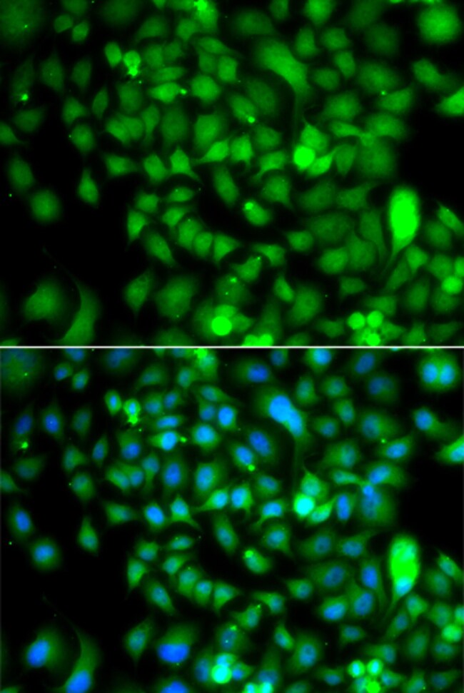 100UL CSRP2BP ANTIBODY 100 ul