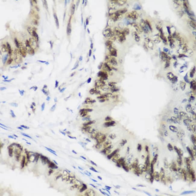 100UL AEBP2 ANTIBODY 100 ul