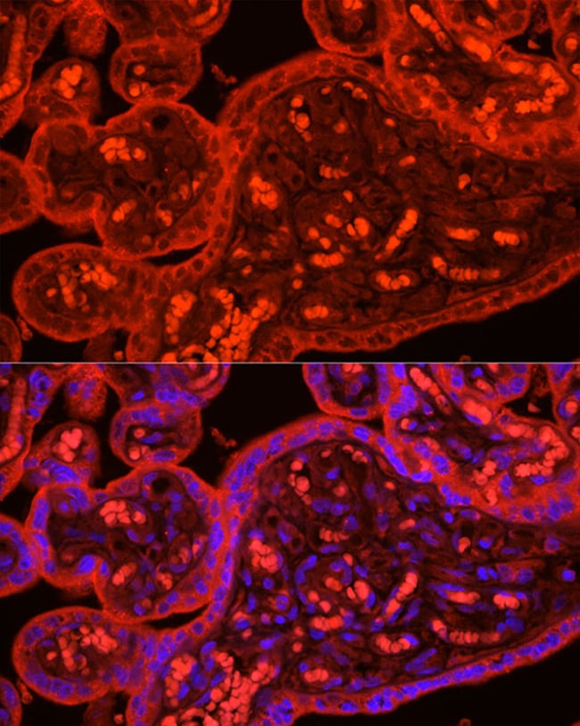 100UL ATG9B ANTIBODY 100 ul
