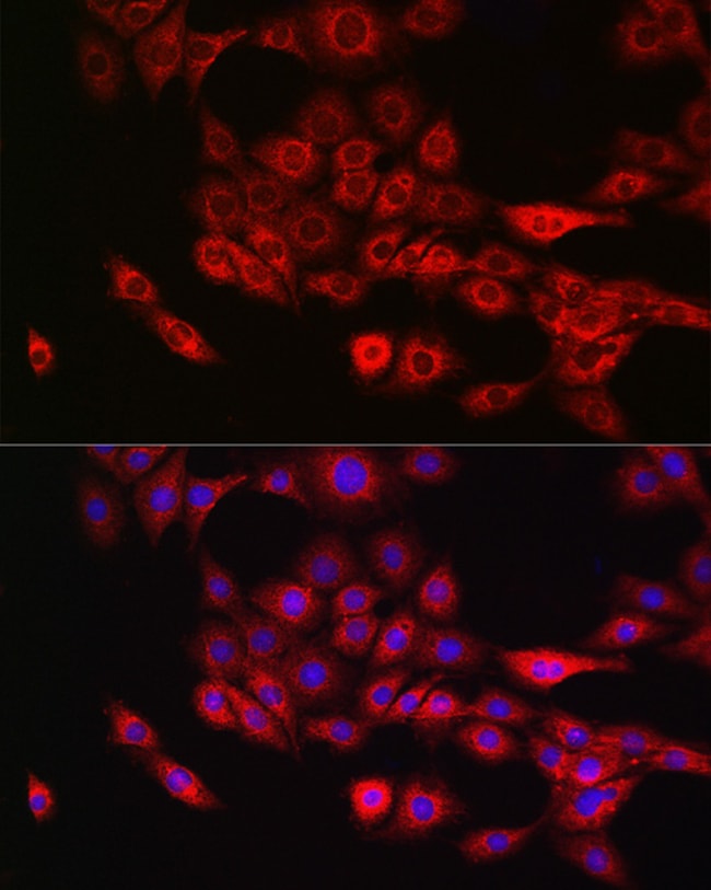 100UL ANNEXIN A11 ANTIBODY 100 ul