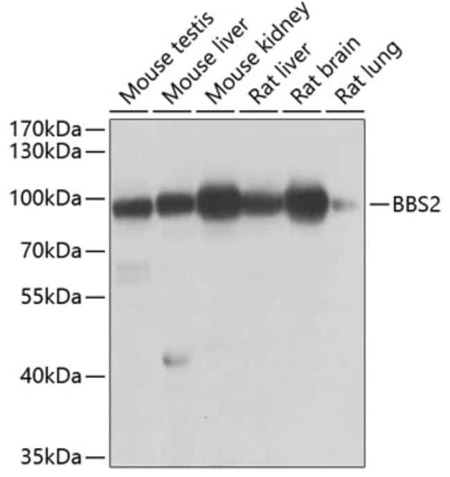 100UL BBS2 ANTIBODY 100 ul