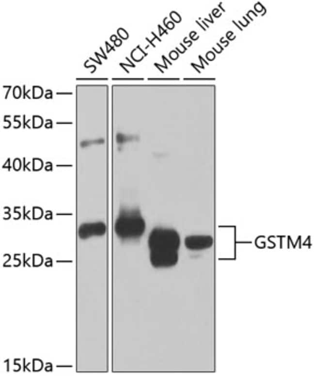 100UL GSTM4 ANTIBODY 100 ul