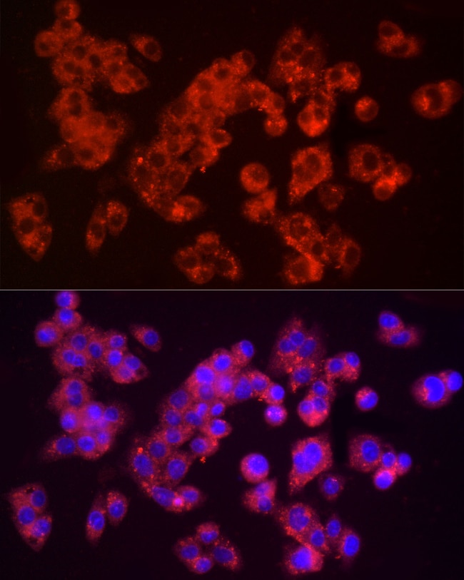 100UL FURIN ANTIBODY 100 ul