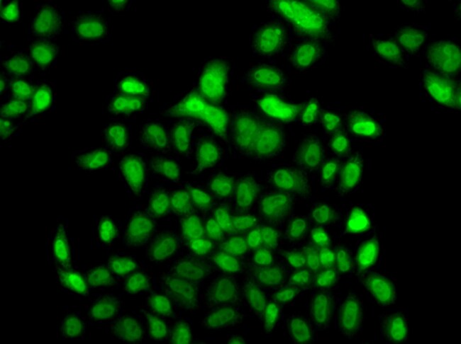 100UL FBXO7 ANTIBODY 100 ul