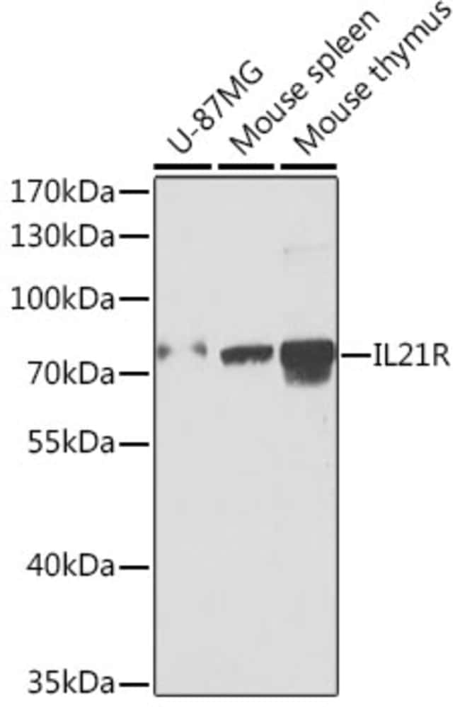 100UL IL21R ANTIBODY 100 ul