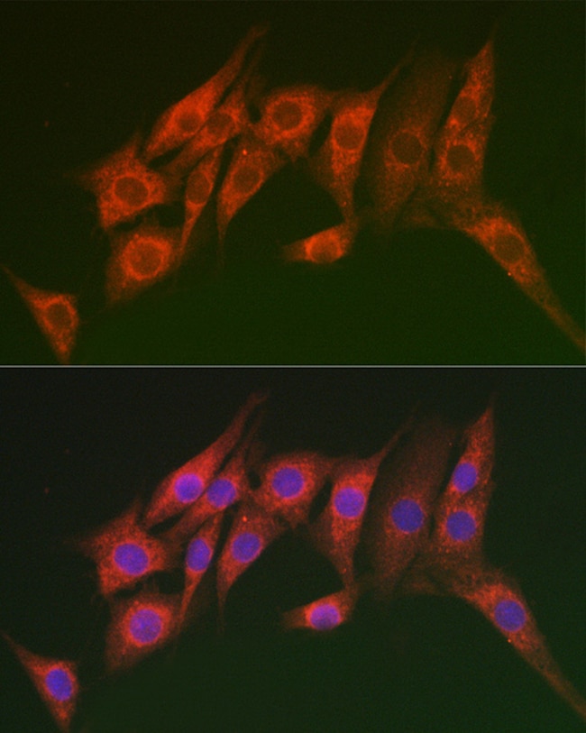 100UL MTMR14 ANTIBODY 100 ul