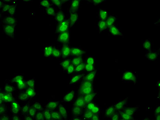 100UL HDGFRP2 ANTIBODY 100 ul