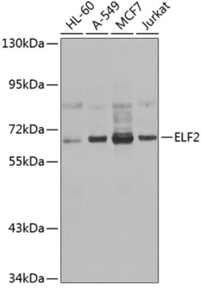 100UL ELF2 ANTIBODY 100 ul