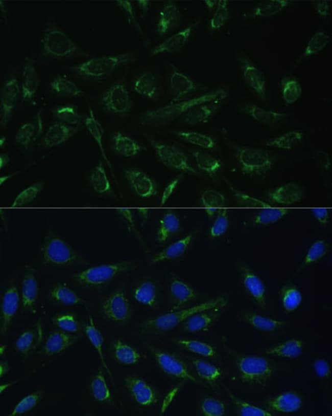 100UL HCCS ANTIBODY 100 ul