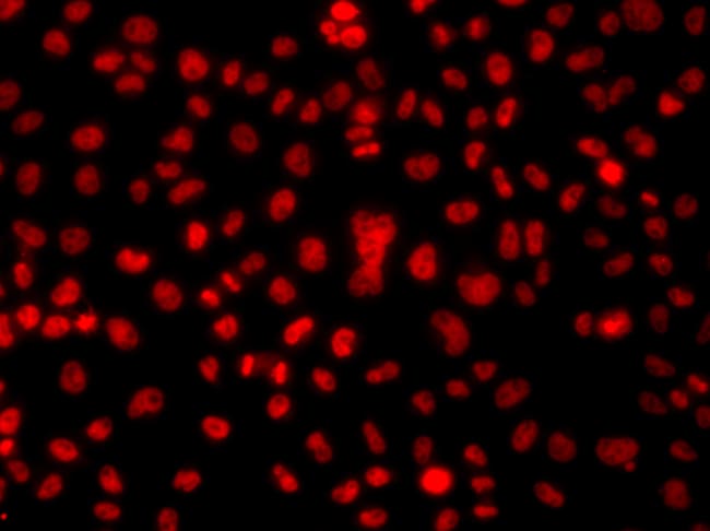 100UL HNRNP A1 ANTIBODY 100 ul