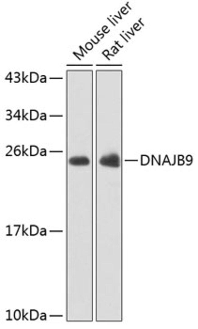 100UL DNAJB9 ANTIBODY 100 ul
