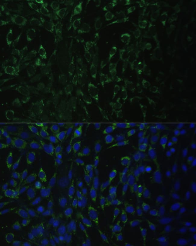 100UL ALDH1A2 ANTIBODY 100 ul