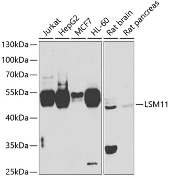 100UL LSM11 ANTIBODY 100 ul