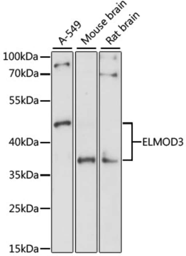 100UL ELMOD3 ANTIBODY 100 ul