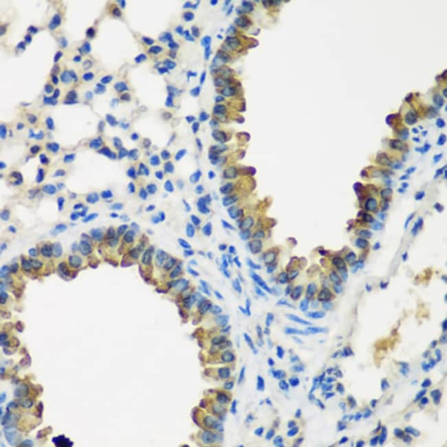 100UL CYP2F1 ANTIBODY 100 ul