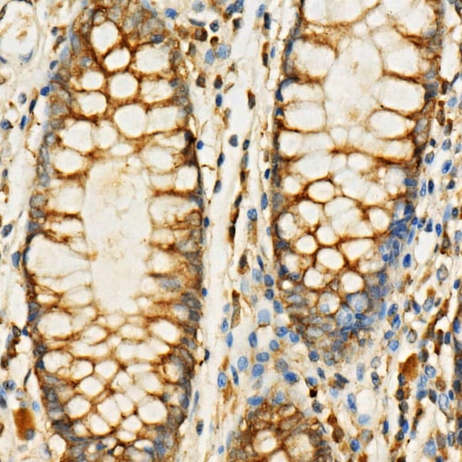 100UL EIF4G ANTIBODY 100 ul