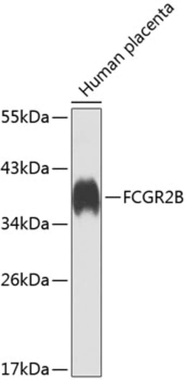 100UL CD32B ANTIBODY 100 ul