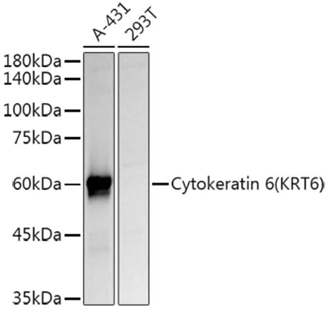 100UL CYTOKERATIN 6A ANTIBODY 100 ul