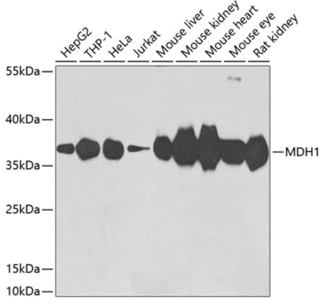 100UL MDH1 ANTIBODY 100 ul