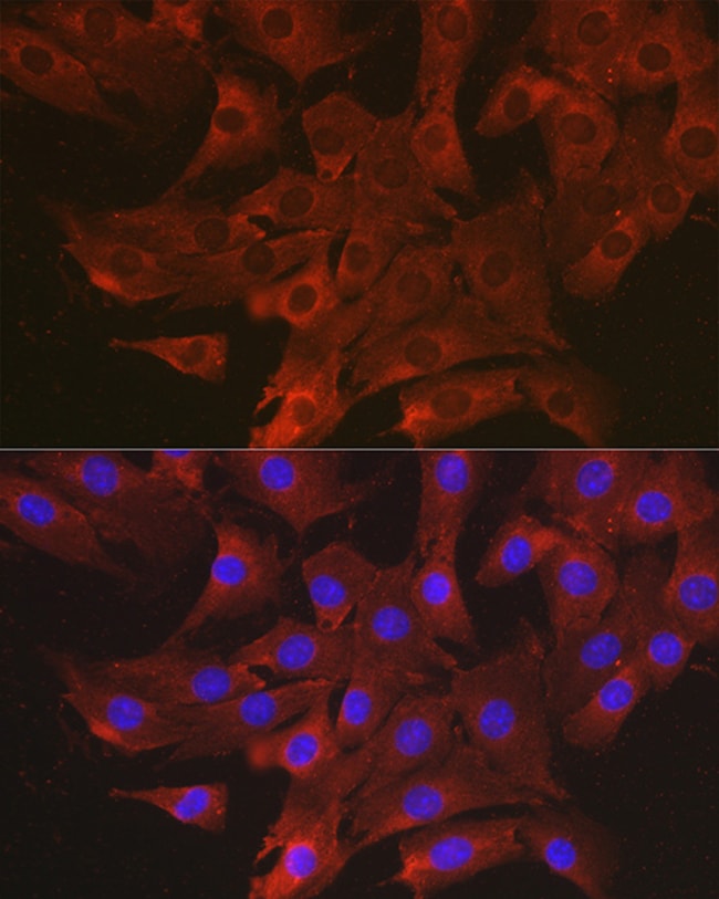 100UL CCL3 ANTIBODY 100 ul