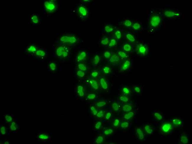 100UL MORF4L2 ANTIBODY 100 ul