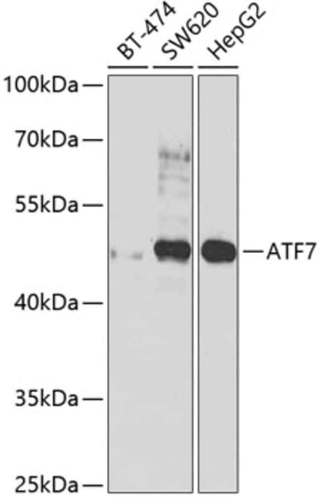 100UL ATF7 ANTIBODY 100 ul