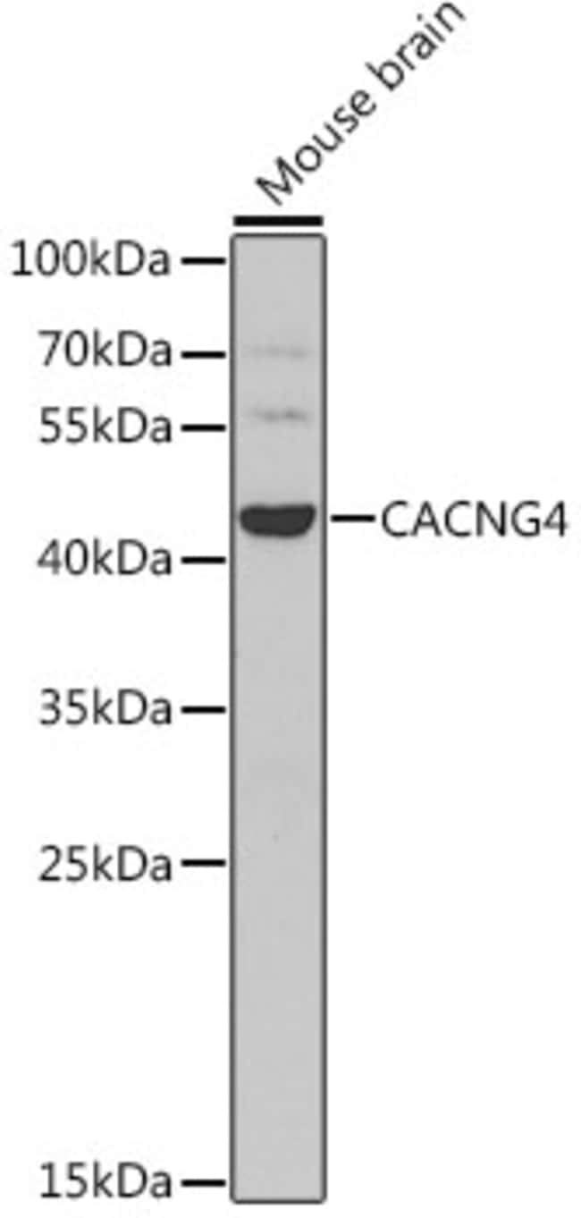 100UL CACNG4 ANTIBODY 100 ul