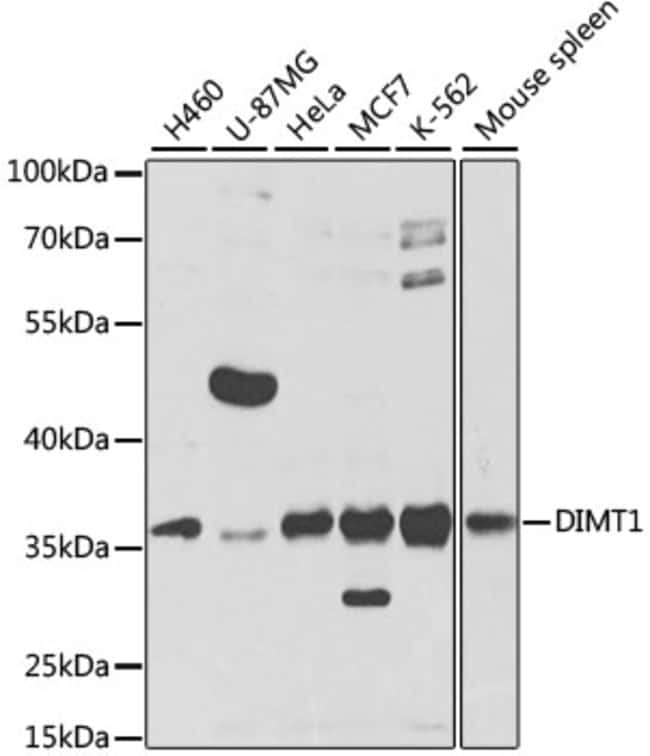 100UL DIMT1 ANTIBODY 100 ul
