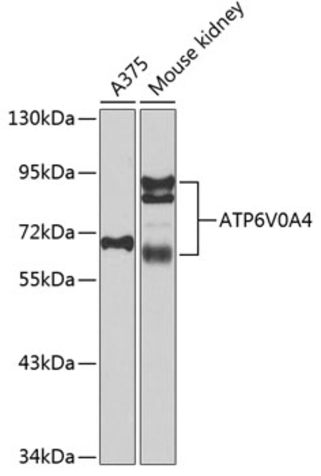 100UL ATP6V0A4 ANTIBODY 100 ul