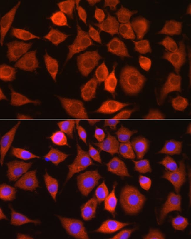 100UL BAX ANTIBODY 100 ul