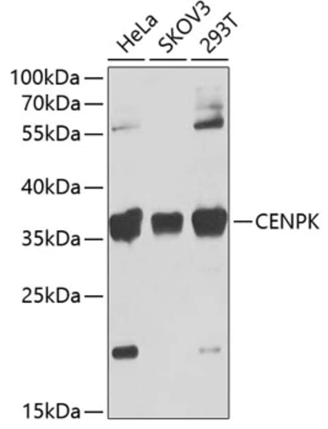 100UL CENPK ANTIBODY 100 ul