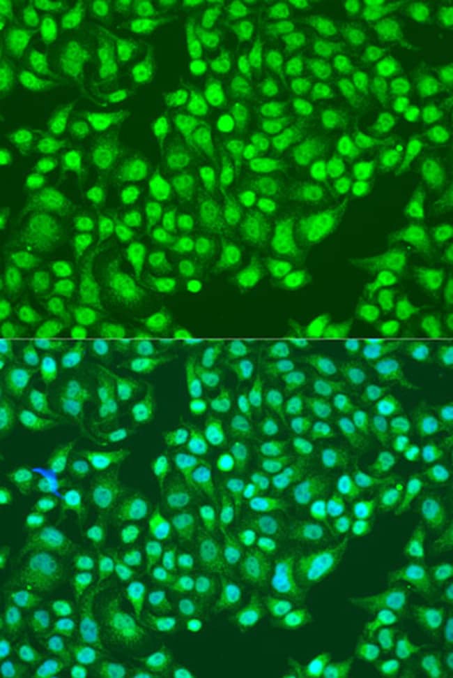 100UL CD49B (INTEGRIN ALPHA 2) ANTIB 100