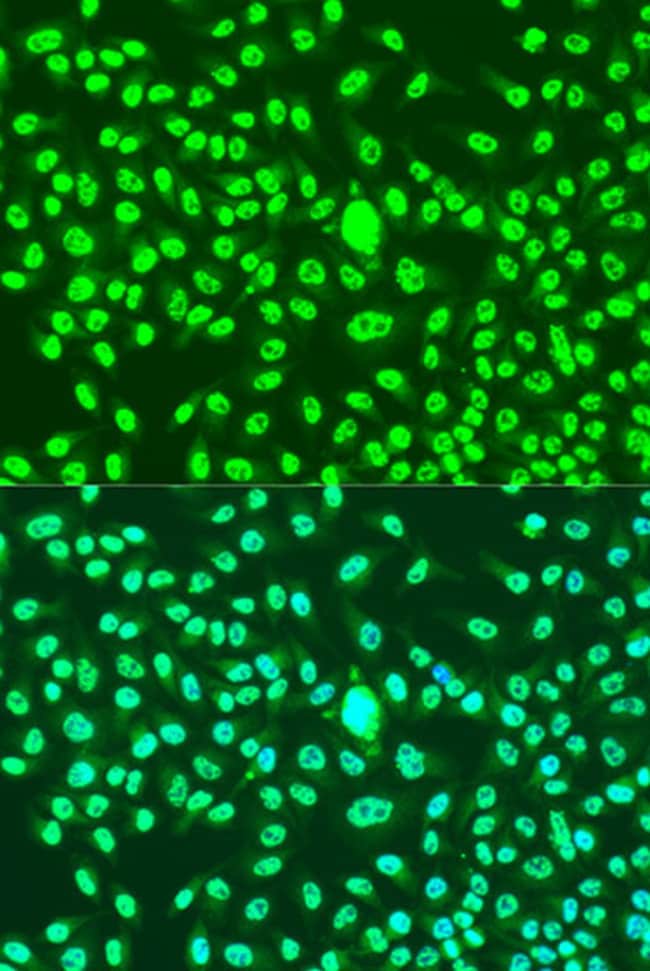 100UL CYCLIN A2 ANTIBODY 100 ul