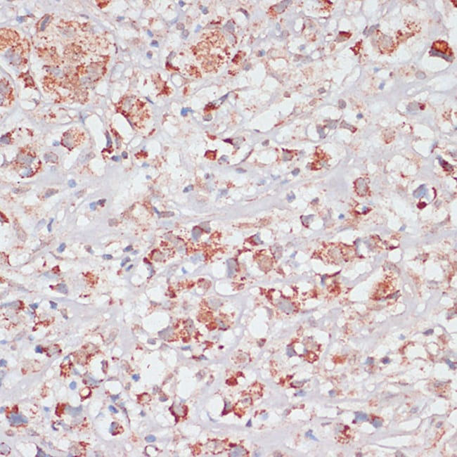100UL DESMOPLAKIN ANTIBODY 100 ul