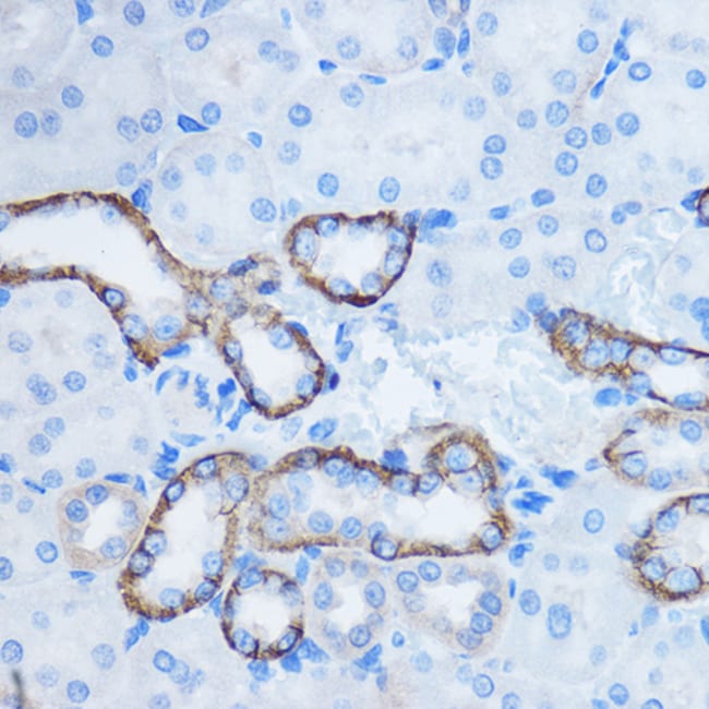 100UL 14-3-3 ZETA ANTIBODY 100 ul