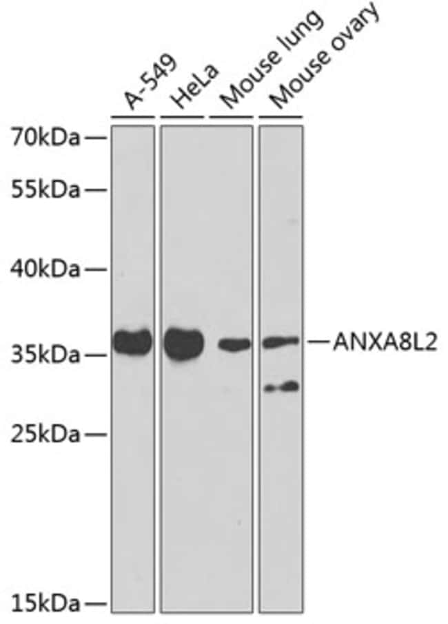 100UL ANXA8L2 ANTIBODY 100 ul
