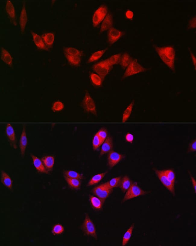 100UL BAAT ANTIBODY 100 ul