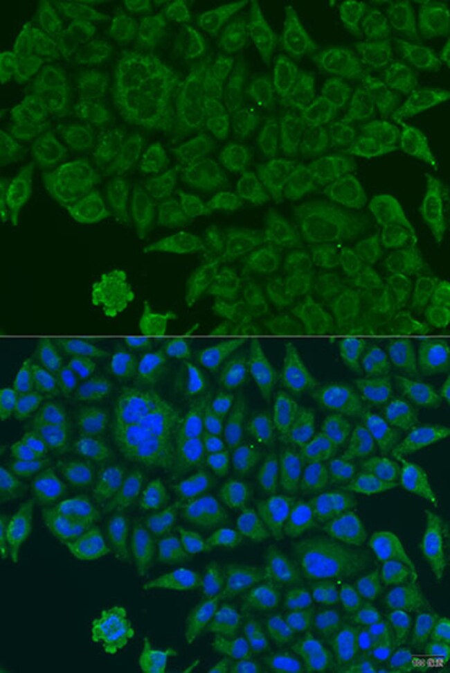 100UL BCS1L ANTIBODY 100 ul
