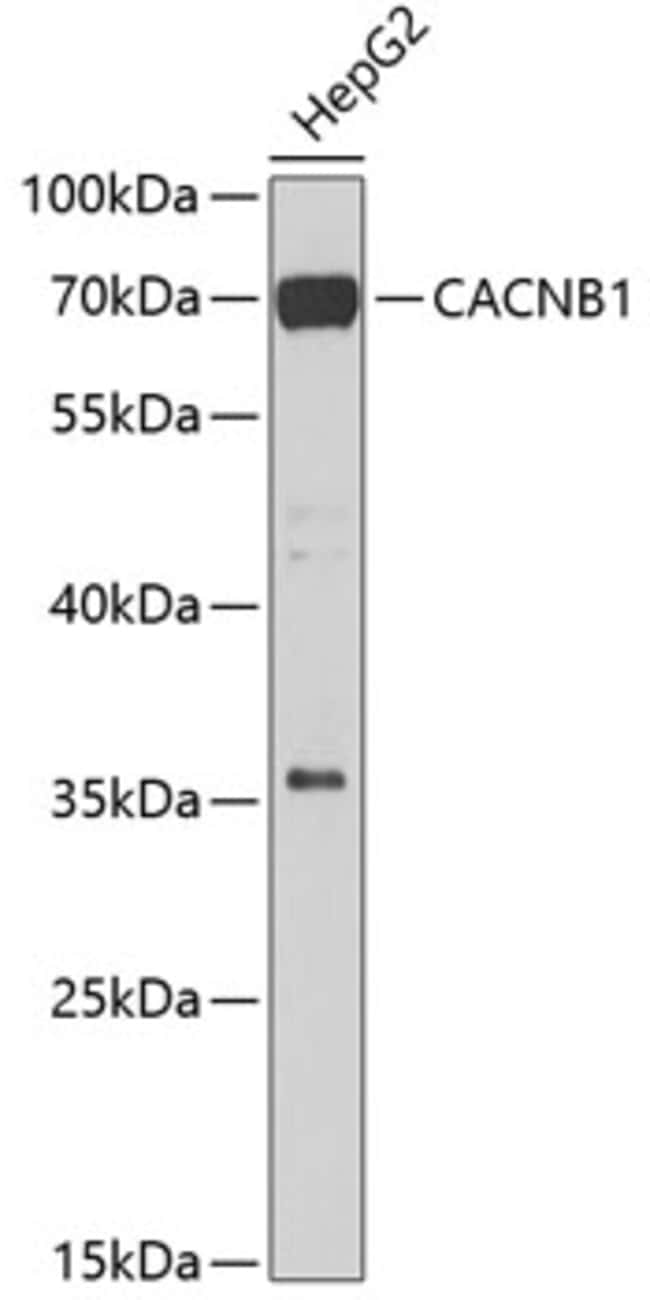 100UL CACNB1 ANTIBODY 100 ul