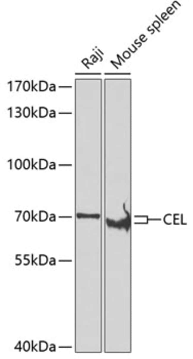 100UL CEL ANTIBODY 100 ul