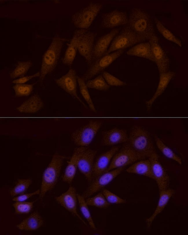 100UL CHK1 ANTIBODY 100 ul