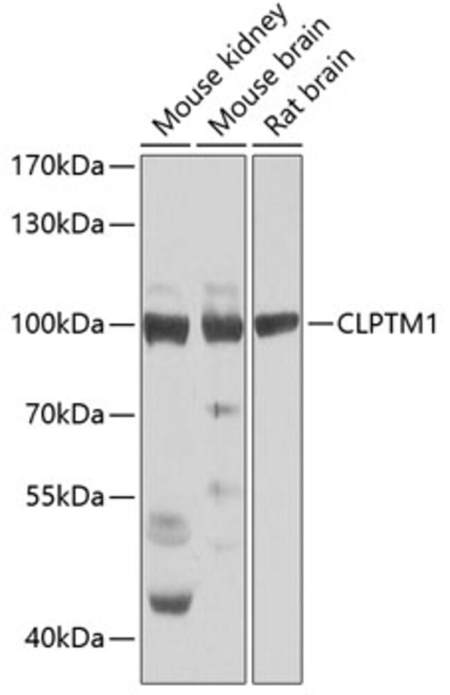 100UL CLPTM1 ANTIBODY 100 ul