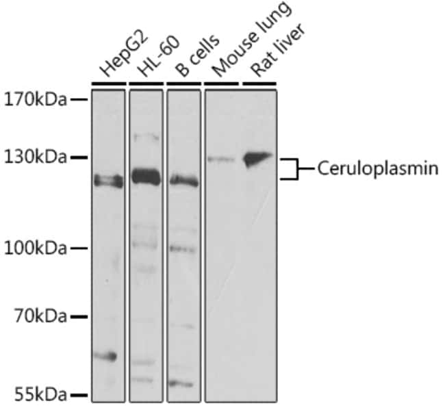 100UL CERULOPLASMIN ANTIBODY 100 ul