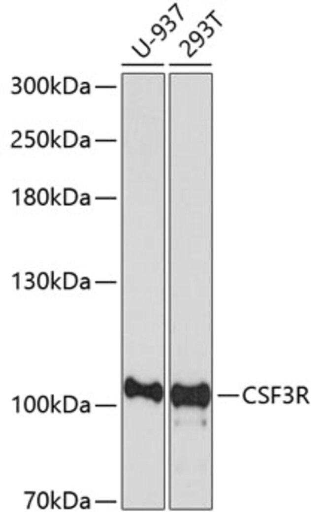 100UL CSF3R ANTIBODY 100 ul